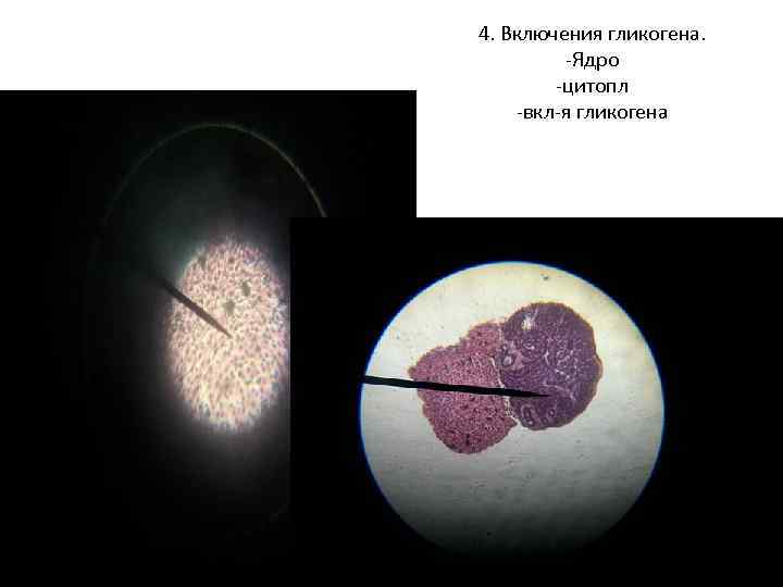 4. Включения гликогена. -Ядро -цитопл -вкл-я гликогена 