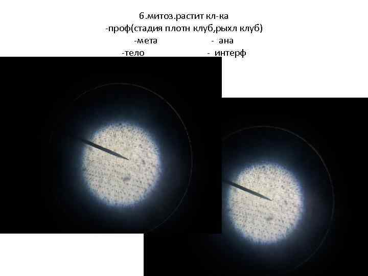 6. митоз. растит кл-ка -проф(стадия плотн клуб, рыхл клуб) -мета - ана -тело -