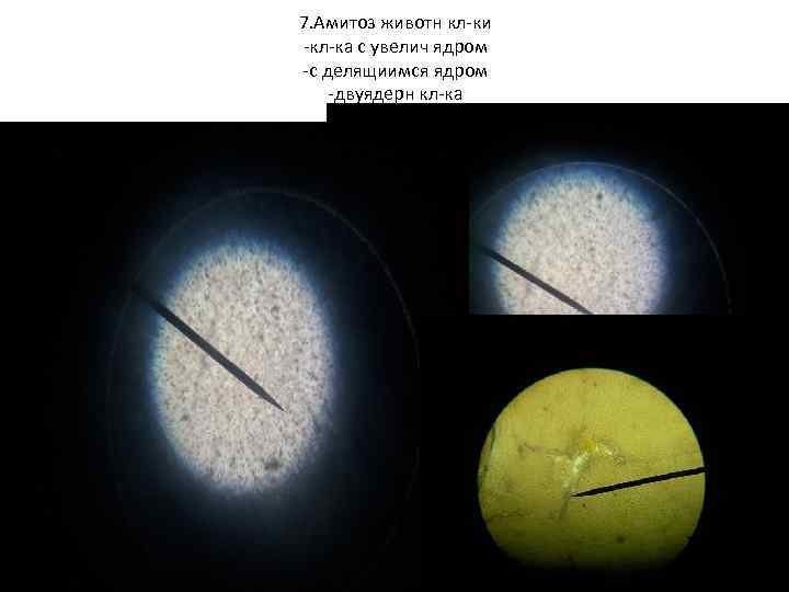 7. Амитоз животн кл-ки -кл-ка с увелич ядром -с делящиимся ядром -двуядерн кл-ка 