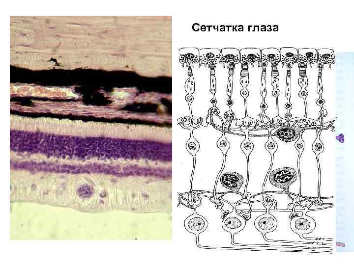 Сетчатка глаза 
