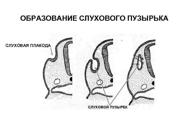 ОБРАЗОВАНИЕ СЛУХОВОГО ПУЗЫРЬКА СЛУХОВАЯ ПЛАКОДА СЛУХОВОЙ ПУЗЫРЕК 