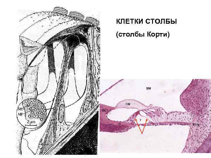 КЛЕТКИ СТОЛБЫ (столбы Корти) 