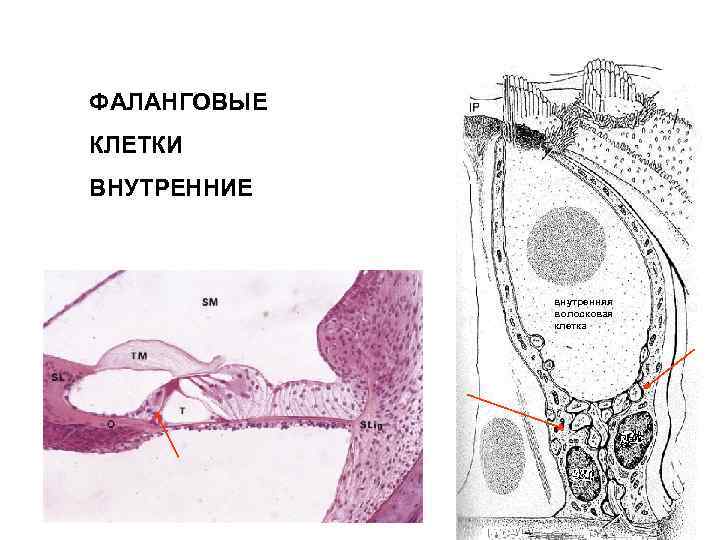 ФАЛАНГОВЫЕ КЛЕТКИ ВНУТРЕННИЕ внутренняя волосковая клетка 