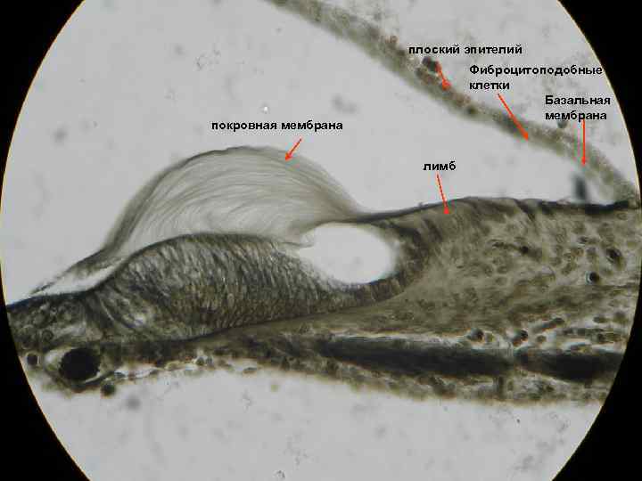плоский эпителий Фиброцитоподобные клетки Базальная мембрана покровная мембрана лимб 
