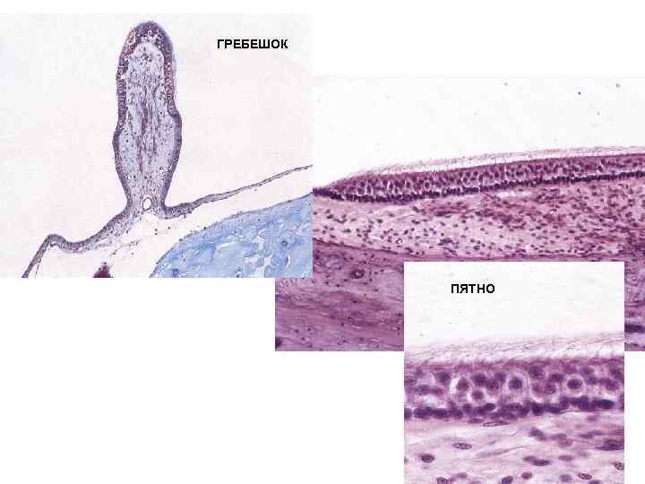 ГРЕБЕШОК ПЯТНО 
