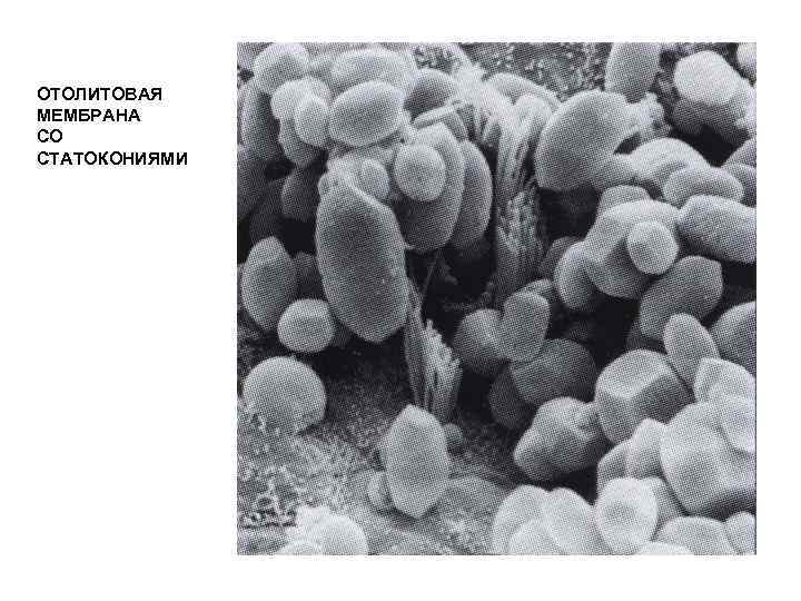 ОТОЛИТОВАЯ МЕМБРАНА СО СТАТОКОНИЯМИ 