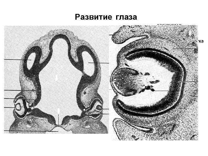 Развитие глаза СОСУДИСТАЯ сетчатка СКЛЕРА 