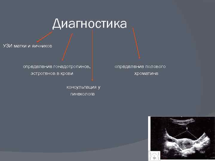 Диагностика УЗИ матки и яичников определение гонадотропинов, определение полового эстрогенов в крови хроматина консультация