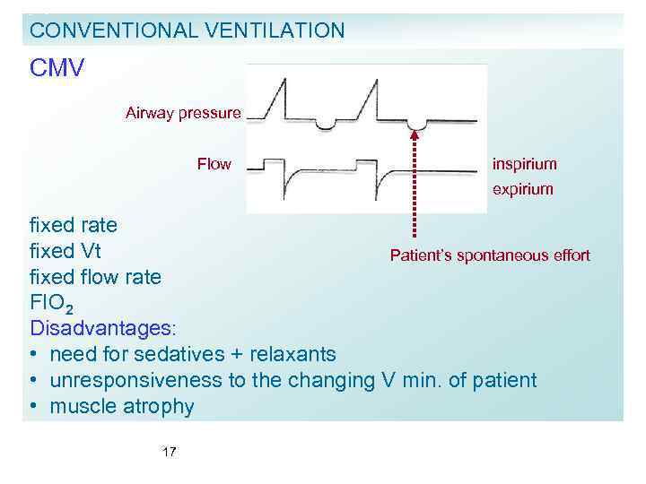 CONVENTIONAL VENTILATION CMV Airway pressure Flow inspirium expirium fixed rate fixed Vt Patient’s spontaneous