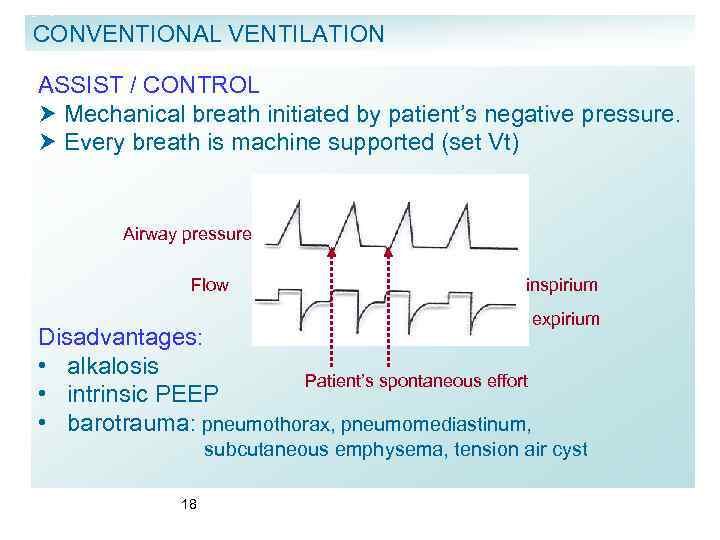 CONVENTIONAL VENTILATION ASSIST / CONTROL Mechanical breath initiated by patient’s negative pressure. Every breath