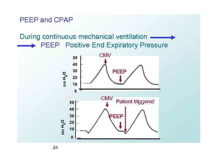 PEEP and CPAP During continuous mechanical ventilation PEEP Positive End Expiratory Pressure 50 CMV