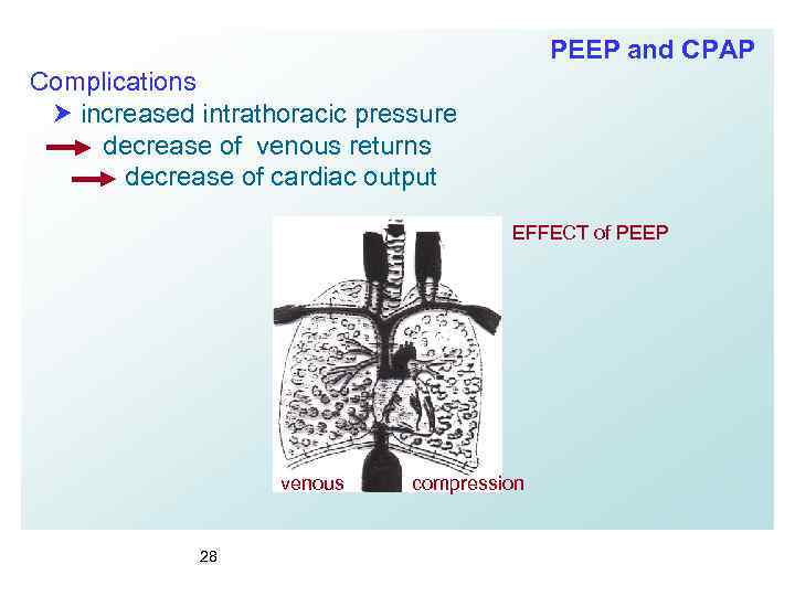 PEEP and CPAP Complications increased intrathoracic pressure decrease of venous returns decrease of cardiac