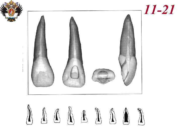 Анатомия корневых каналов презентация