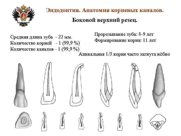 Схема корневых каналов