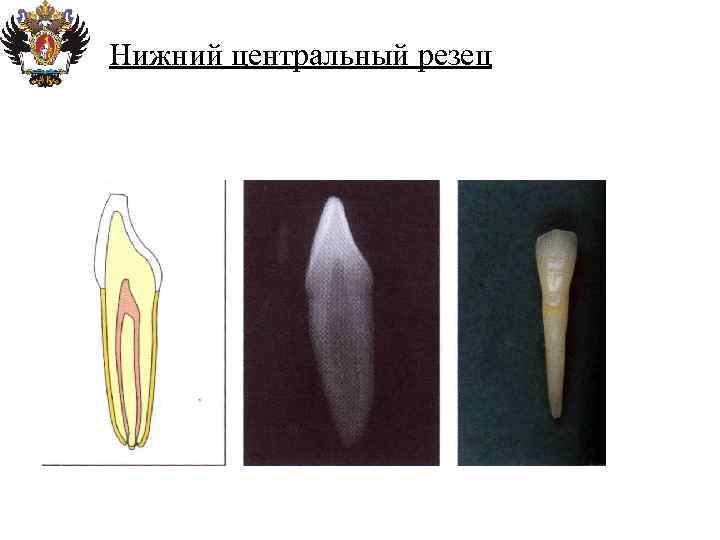 Анатомия корневых каналов презентация