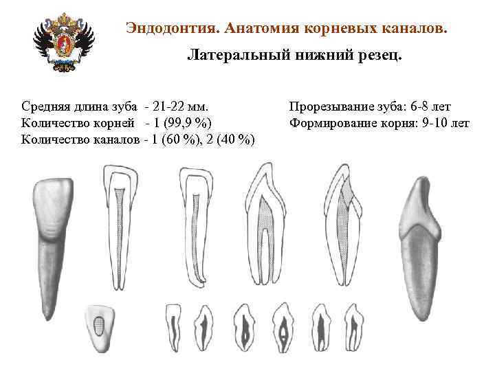 Эндодонтия. Анатомия корневых каналов. Латеральный нижний резец. Средняя длина зуба - 21 -22 мм.