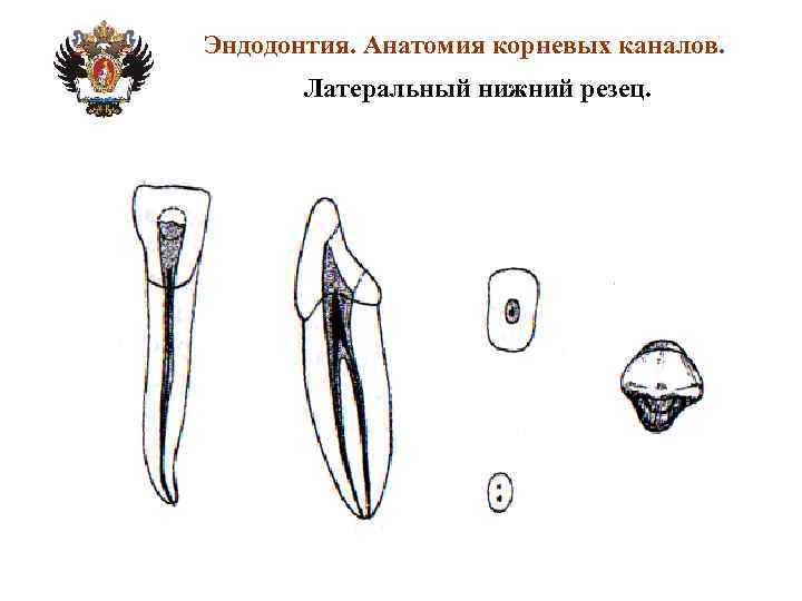 Схема корневых каналов