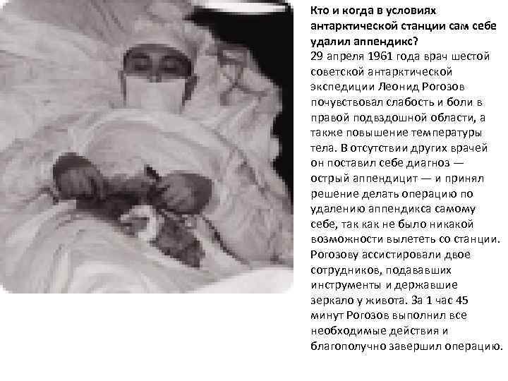 Кто и когда в условиях антарктической станции сам себе удалил аппендикс? 29 апреля 1961