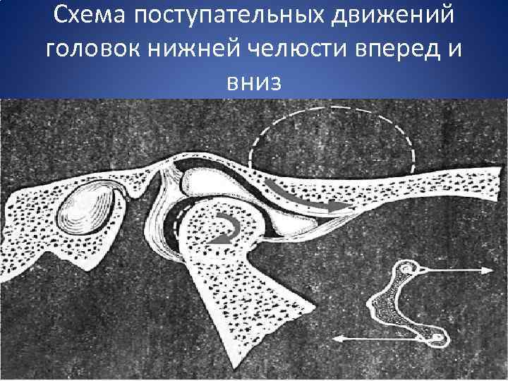 Схема поступательных движений головок нижней челюсти вперед и вниз 