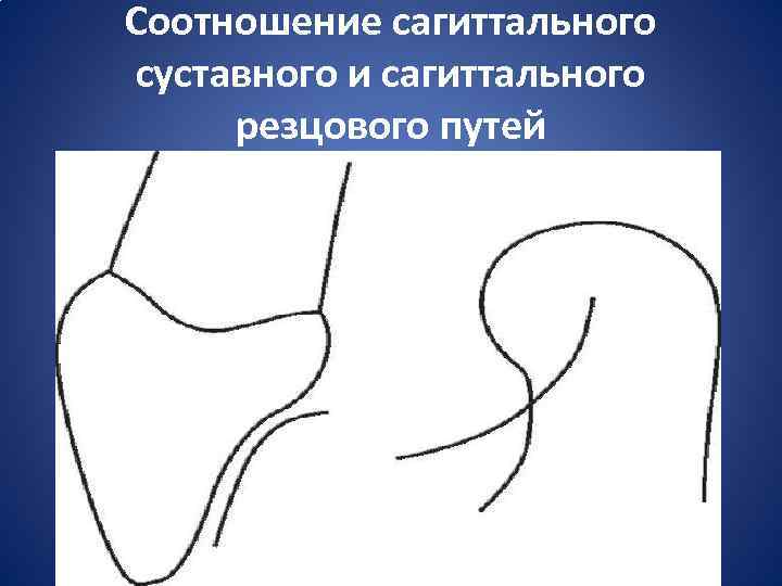 Соотношение сагиттального суставного и сагиттального резцового путей 