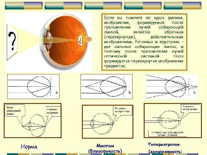 Если вы помните из курса физики, изображение, формируемое после преломления лучей собирающей линзой, является