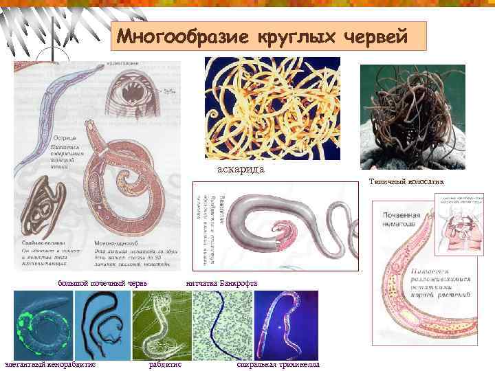 Многообразие круглых червей аскарида Типичный волосатик большой почечный червь элегантный кенорабдитис нитчатка Банкрофта рабдитис