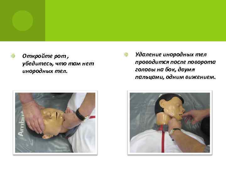  Откройте рот , убедитесь, что там нет инородных тел. Удаление инородных тел проводится