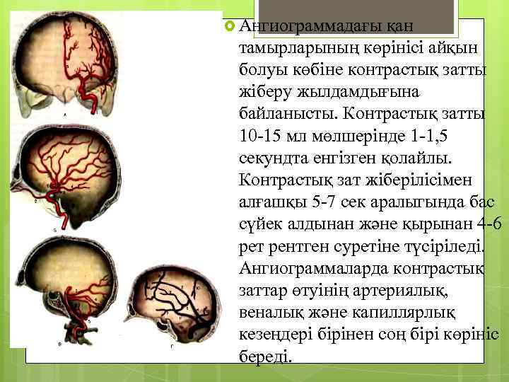  Ангиограммадағы қан тамырларының көрінісі айқын болуы көбіне контрастық затты жіберу жылдамдығына байланысты. Контрастық