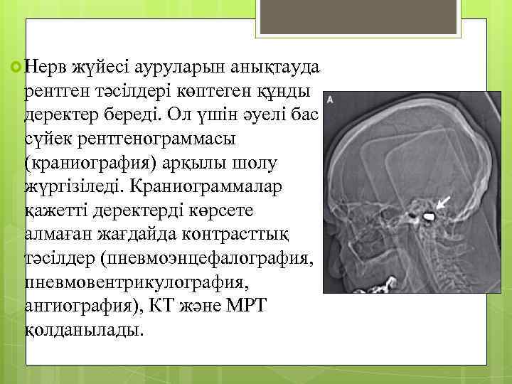  Нерв жүйесі ауруларын анықтауда рентген тәсілдері көптеген құнды деректер береді. Ол үшін әуелі