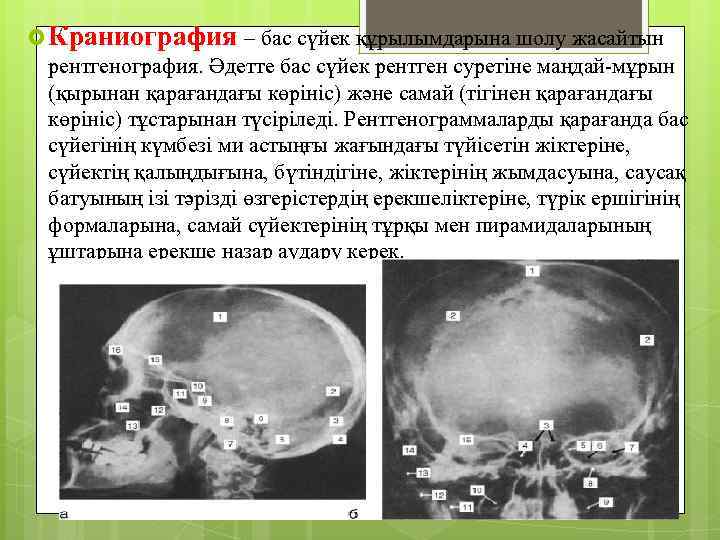  Краниография – бас сүйек құрылымдарына шолу жасайтын рентгенография. Әдетте бас сүйек рентген суретіне