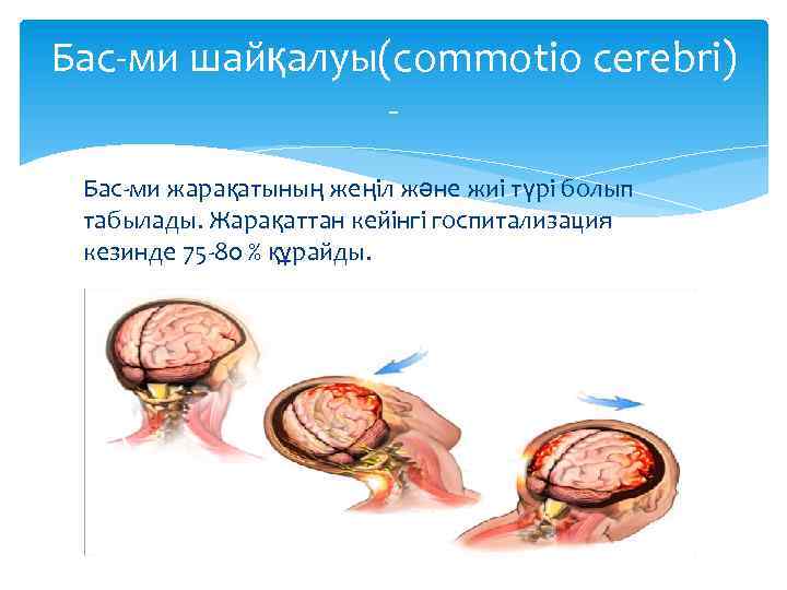 Бас-ми шайқалуы(commotio cerebri) Бас-ми жарақатының жеңіл және жиі түрі болып табылады. Жарақаттан кейінгі госпитализация