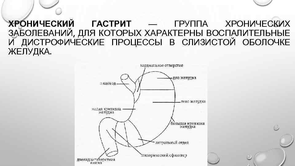 ХРОНИЧЕСКИЙ ГАСТРИТ — ГРУППА ХРОНИЧЕСКИХ ЗАБОЛЕВАНИЙ, ДЛЯ КОТОРЫХ ХАРАКТЕРНЫ ВОСПАЛИТЕЛЬНЫЕ И ДИСТРОФИЧЕСКИЕ ПРОЦЕССЫ В