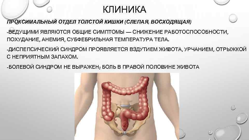КЛИНИКА ПРОКСИМАЛЬНЫЙ ОТДЕЛ ТОЛСТОЙ КИШКИ (СЛЕПАЯ, ВОСХОДЯЩАЯ) -ВЕДУЩИМИ ЯВЛЯЮТСЯ ОБЩИЕ СИМПТОМЫ — СНИЖЕНИЕ РАБОТОСПОСОБНОСТИ,
