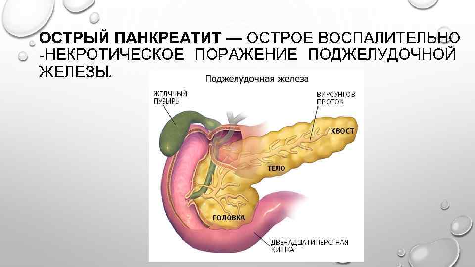 Бад поджелудочная железа. Острый панкреатит поджелудочной железы. Болезни пищеварительной системы человека панкреатит. Поджелудочная железа при остром панкреатите. Острый панкреатит хронический панкреатит.