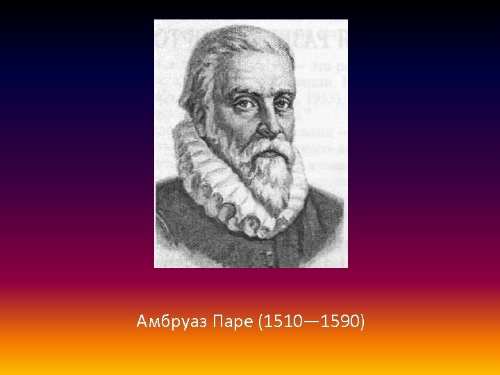 Амбруаз Паре (1510— 1590) 