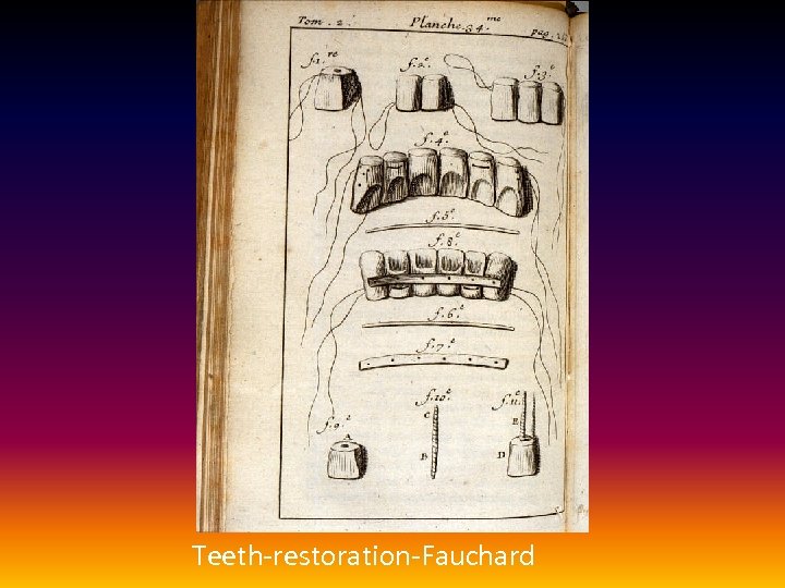 Teeth-restoration-Fauchard 