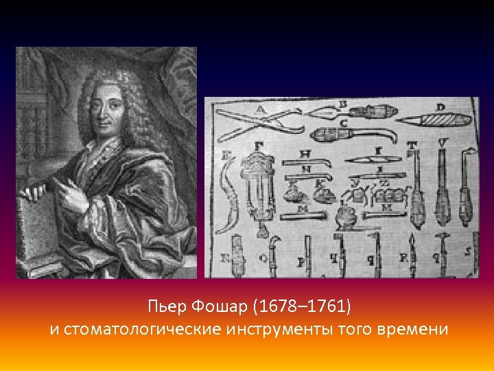 Пьер Фошар (1678– 1761) и стоматологические инструменты того времени 