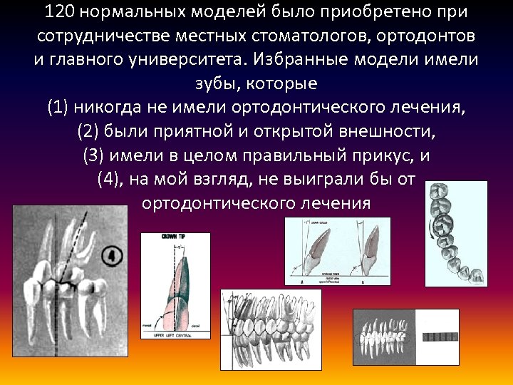 120 нормальных моделей было приобретено при сотрудничестве местных стоматологов, ортодонтов и главного университета. Избранные
