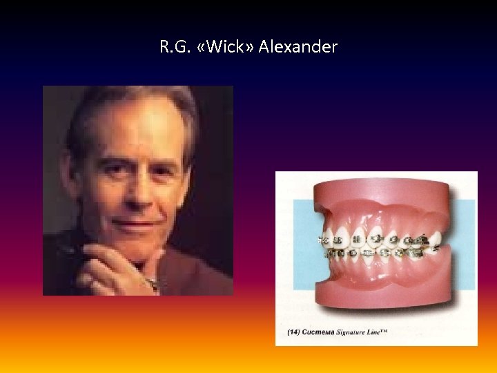 R. G. «Wick» Alexander 