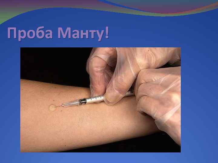 Проба Манту! 