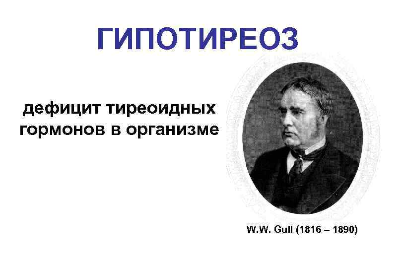 ГИПОТИРЕОЗ дефицит тиреоидных гормонов в организме W. W. Gull (1816 – 1890) 