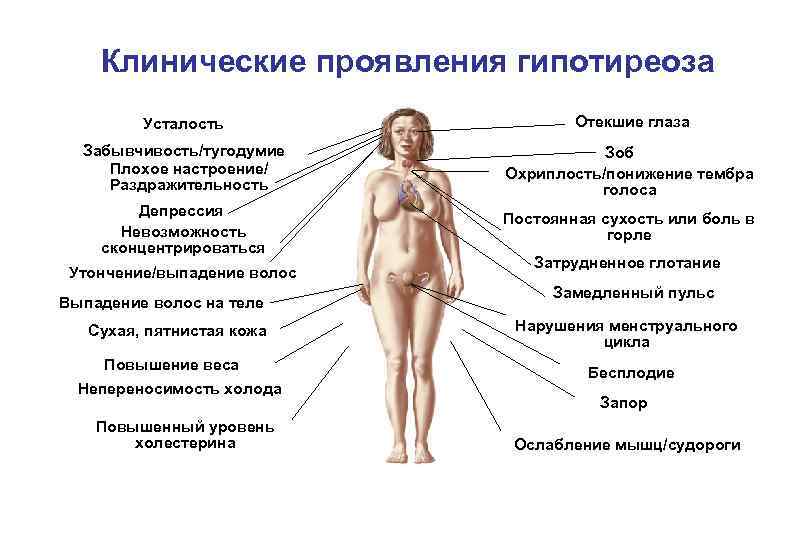 Клинические проявления гипотиреоза Усталость Отекшие глаза Забывчивость/тугодумие Плохое настроение/ Раздражительность Зоб Охриплость/понижение тембра голоса