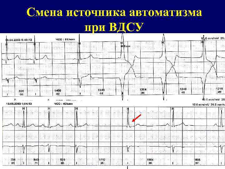 Смена источника автоматизма при ВДСУ 