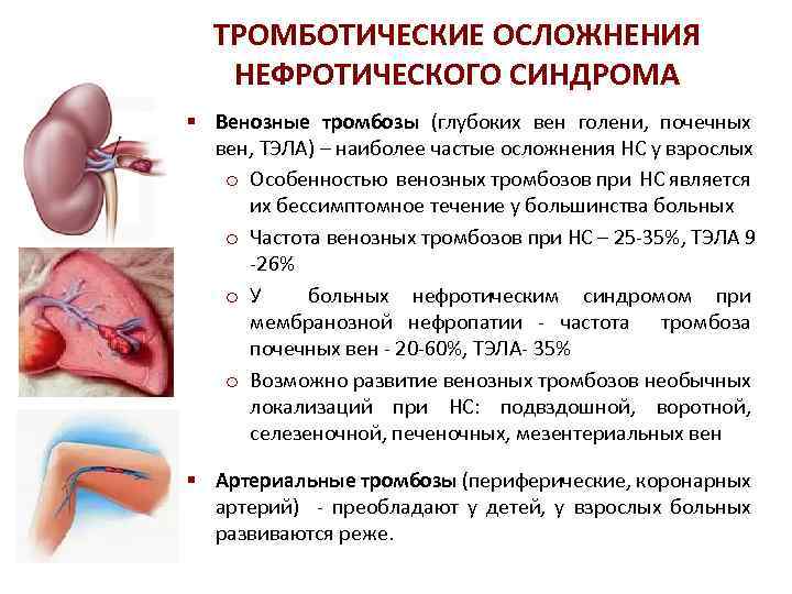 Тромбоз глубоких вен голени фото