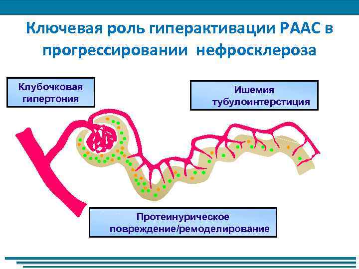 Ключевая роль гиперактивации РААС в прогрессировании нефросклероза Клубочковая гипертония Ишемия тубулоинтерстиция Протеинурическое повреждение/ремоделирование 