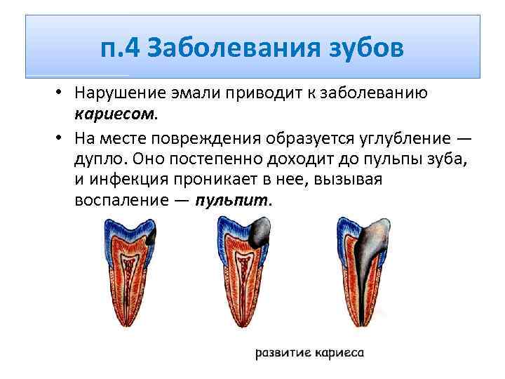 п. 4 Заболевания зубов • Нарушение эмали приводит к заболеванию кариесом. • На месте