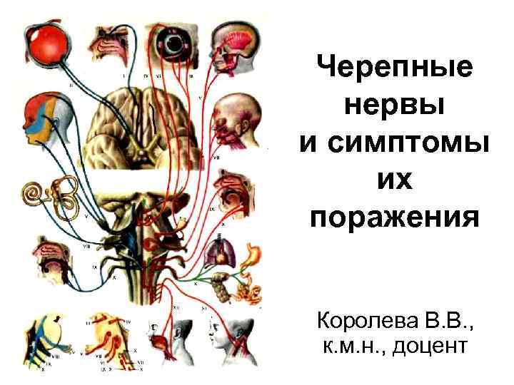 Поражение черепного. Поражение ЧМН неврология таблица. Поражение 12 пары черепных нервов. Симптомы поражения черепных нервов. Черепные нервы поражение.