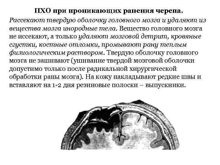 ПХО при проникающих ранения черепа. Рассекают твердую оболочку головного мозга и удаляют из вещества