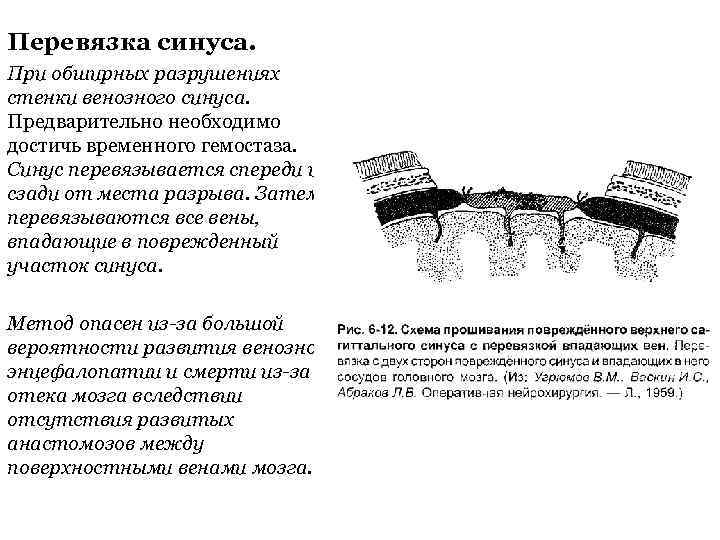 Перевязка синуса. При обширных разрушениях стенки венозного синуса. Предварительно необходимо достичь временного гемостаза. Синус