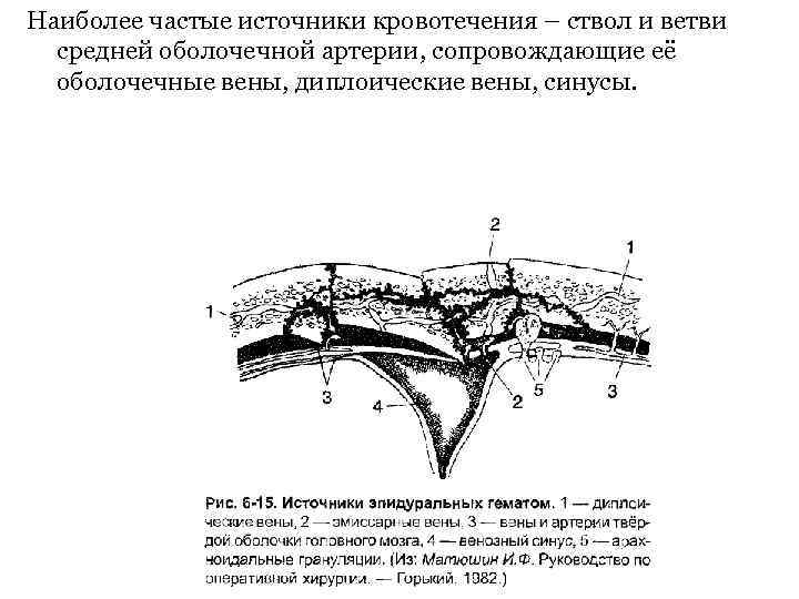 По схеме кренлейна брюсовой основной ствол средней менингеальной артерии проецируется на пересечении